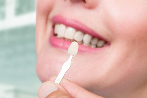 Ein Zahntechniker macht einen Farbabgleich mit einem Zahnmuster